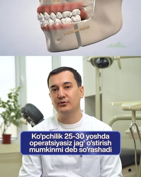 Jagʻlarni 25-30 yoshda oʻstirish mumkinmi?